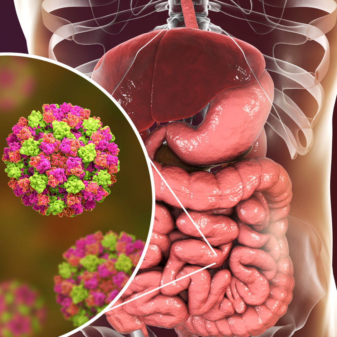 O ilustrare medicală a sistemului digestiv uman, cu un detaliu al unui virus rotund, colorat în nuanțe de roz și verde, reprezentând o infecție intestinală.